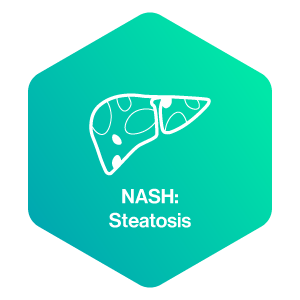 NASH: Steatosis