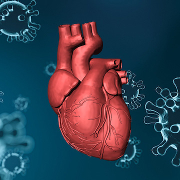 The Catastrophic Impact Of COVID-19 On Cardiovascular Risk - SomaLogic