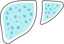 SomaSignal_Tests_Icons_body fat_nash ballooning