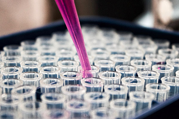 Image of fluid samples being deposited in a lab