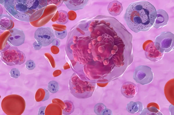 Proteomic profiling for discovery of biomarkers and mechanistic ...