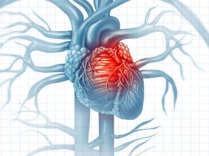 Illustration of human heart during a cardiovascular event