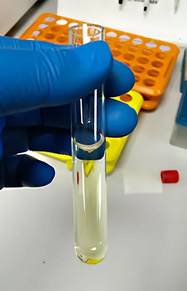 Gloved hand in a lab, holding sample of cerebrospinal fluid